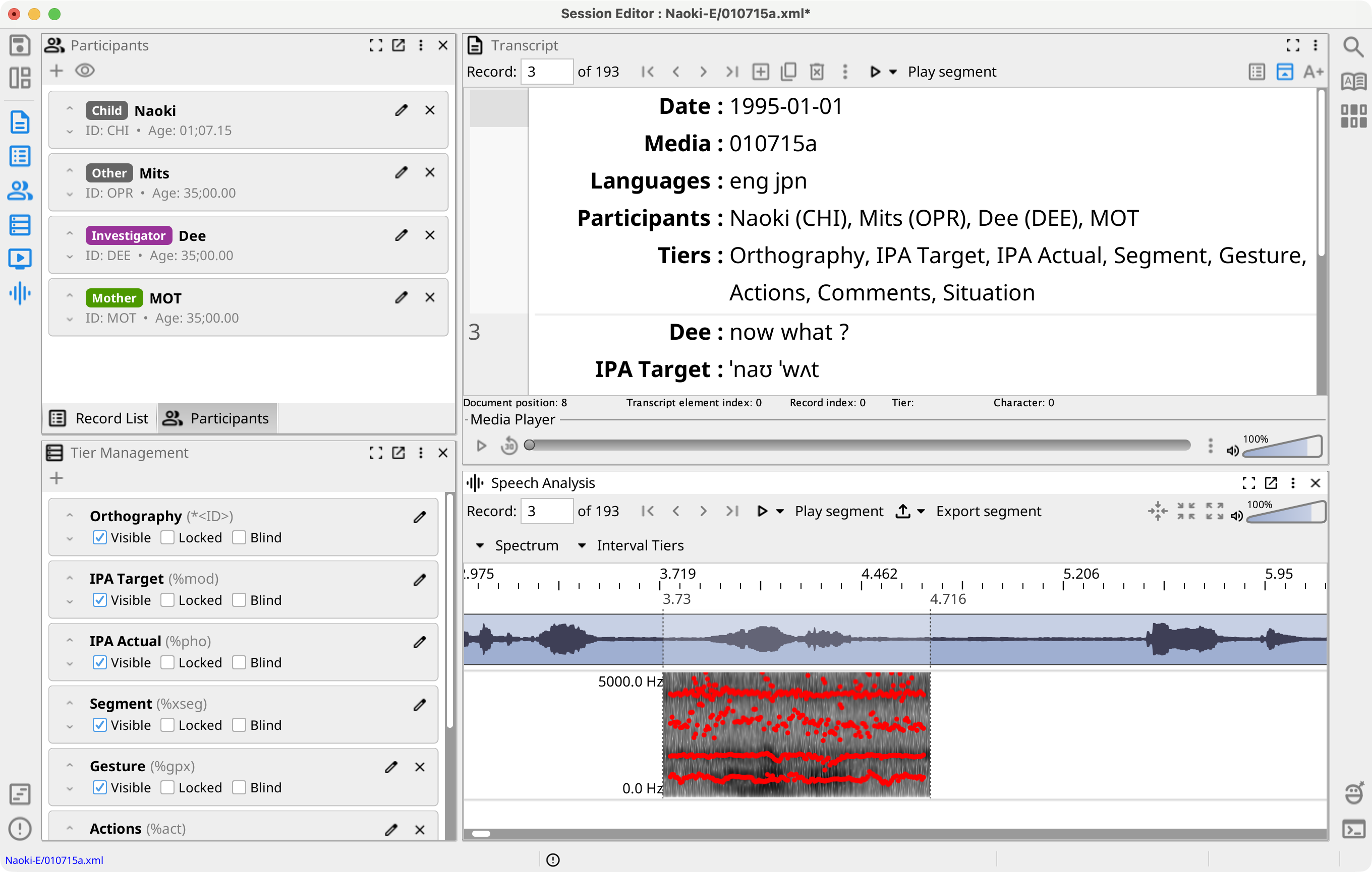 Speech Analysis View