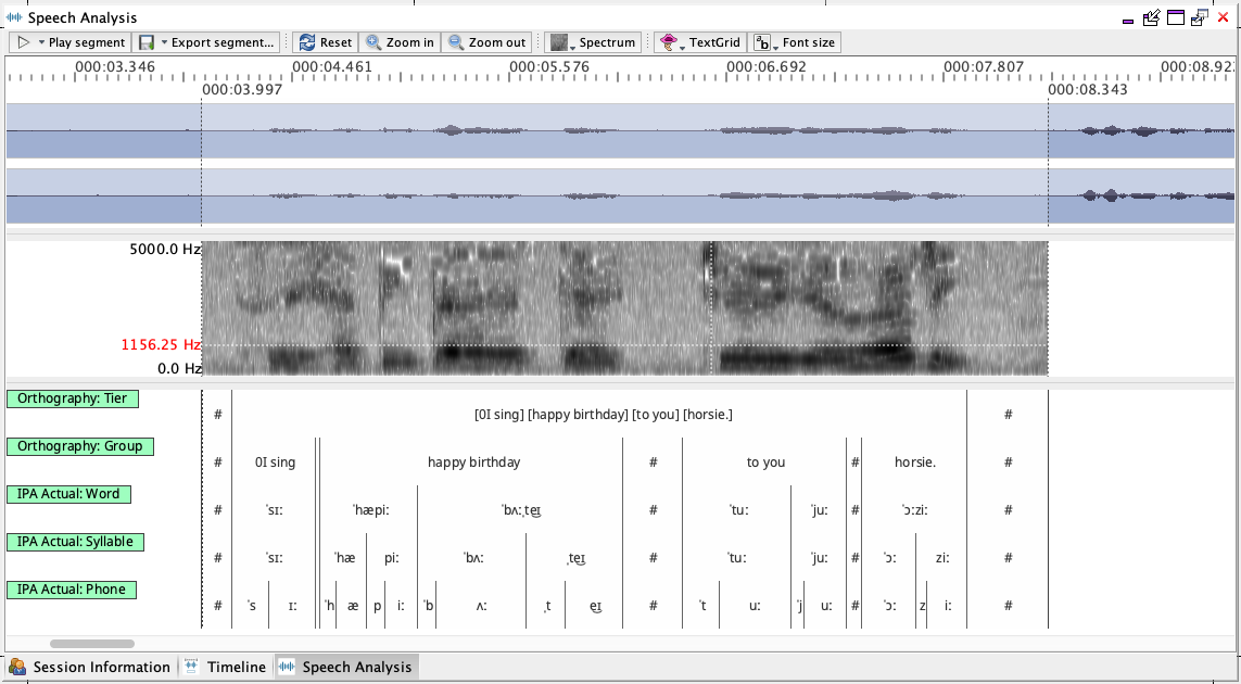 Speech Analysis View